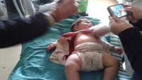 Nusra Teröristleri Geçen Yıl Dört Yaşındaki Çocuğu Şehid Etmeleri Ardından Dünde 3 Aylık Kardeşini Yaraladılar