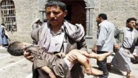 Arabistan’ın Yemen cinayetlerini örtbas çabaları