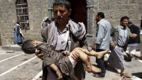 Suudi Amerika Ve Uşaklarına Bağlı Savaş Uçakları Yemen Halkını Yakıcı Bombalarla Vurdu