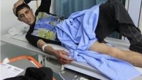 Dün Gece Siyonist İşgal Güçlerinin Saldırısında 2 Filistinli Genç Yaralandı…