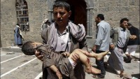 Foto: IŞİD’e Bağlı Unsurların Yemen’de Camilere Düzenlediği Terör Saldırısından Görüntüler.