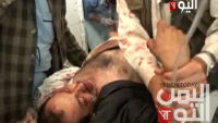 Siyonist Suud Uçakları, Sana’da Cemaat Namaz Üzerindeyken Camiyi Bombaladı: 3 Şehid, 17 Yaralı