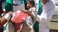 Yemen uluslararası camianın Suudi Arabistan’a sessiz kalmasını kınadı