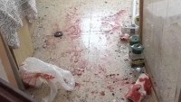 Gazze Direnişi Askalan Kasabasını Füzelerle Vurmaya Devam Ediyor: 1 Siyonist Ölü, 4 Siyonist’te Ağır Yaralı