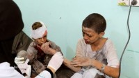 Yemen sağlık bakanlığı: Saldırgan koalisyon güçleri soykırım yapıyor