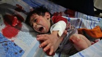 UNICEF’ten Suriye’de çocuk ölüm uyarısı