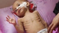 Yemen savaşında şimdiye kadar 5 bin çocuk öldürüldü