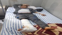 Teröristlerin Şam Kırsalına Füzeli Saldırılarında Şehid Olanların Sayısı 12’ye Yükseldi