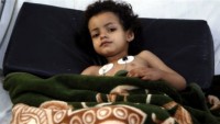 Yemen’de milyonlarca insan aç