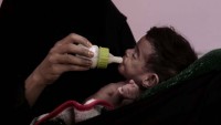 BM: ‘Yemen’de 18 milyon kişi açlık tehlikesi altında’