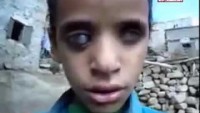 Video: Burası Suudi Amerika ve onun destekçisi olan Türkiye yönetiminin 2015’in Mart ayından beri sivil halkı bombalarla katlettiği Yemen…..