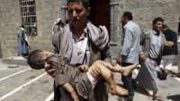 Suudi Arabistan’ın Yemen’e kanlı saldırıları sürüyor