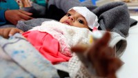 Arabistan ve ABD Yemen halkını kolera virüsü ile öldürüyor