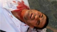Filistinli bir genç daha Siyonistlerin saldırısına uğradı