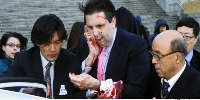 Amerikan’ın Güney Kore Büyükelçisi Devrimci Bir Korelinin Falçatalı Saldırısına Uğrayarak Yaralandı…