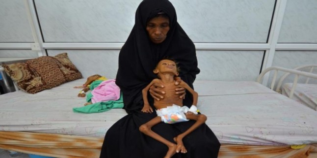 UNİCEF: Suudi Arabistan’ın Yemen’e Açtığı Savaş, ”Çocuklara Karşı Savaş”tır